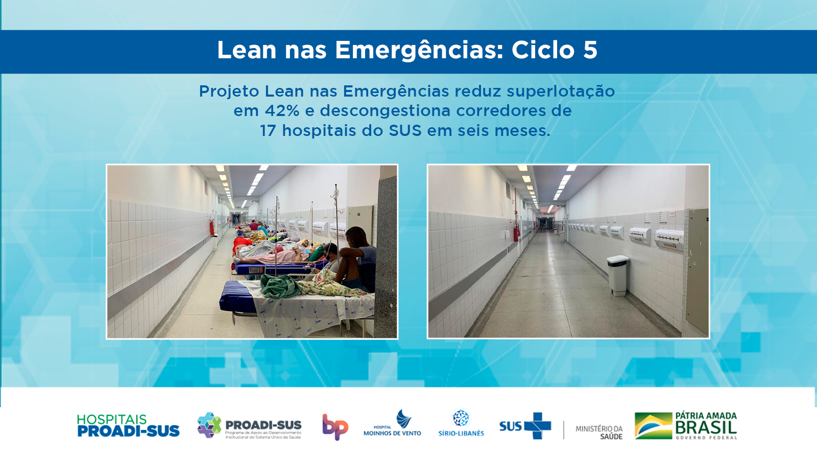 Projeto Lean nas Emergências celebra redução de 43% no índice de superlotação em hospitais públicos e filantrópicos